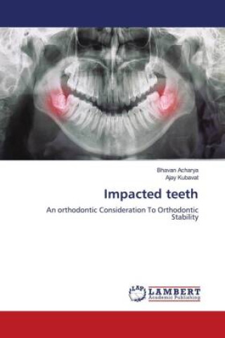 Βιβλίο Impacted teeth Ajay Kubavat
