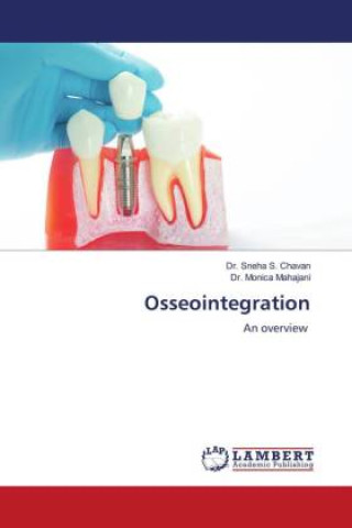 Knjiga Osseointegration Monica Mahajani