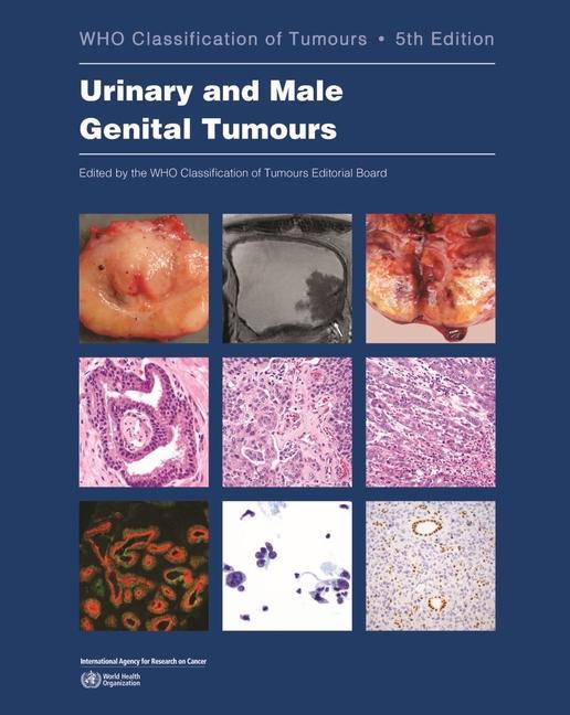 Könyv Urinary and Male Genital Tumours 
