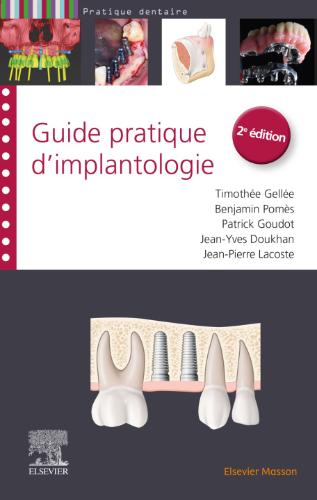 Книга Guide pratique d'implantologie Docteur Timothée Gellée