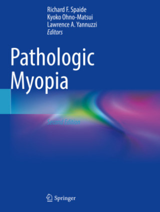 Kniha Pathologic Myopia Richard F. Spaide