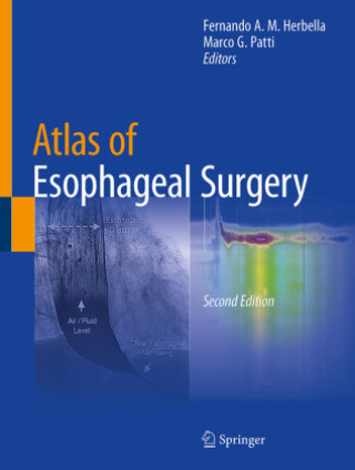 Carte Atlas of Esophageal Surgery Fernando A. M. Herbella