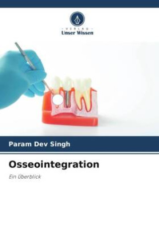 Book Osseointegration Varun Kumar