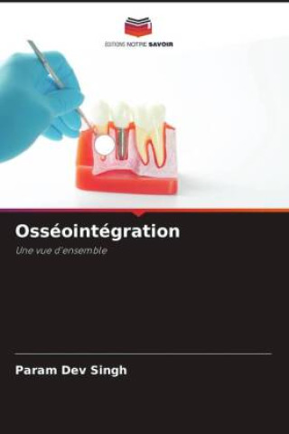 Book Osséointégration Varun Kumar