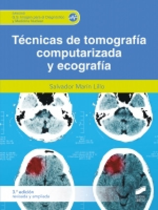 Buch TECNICA DE TOMOGRAFIA COMPUTARIZADA Y ECOGRAFIA 3A EDICION REVISADA SALVADOR MARIN LILLO