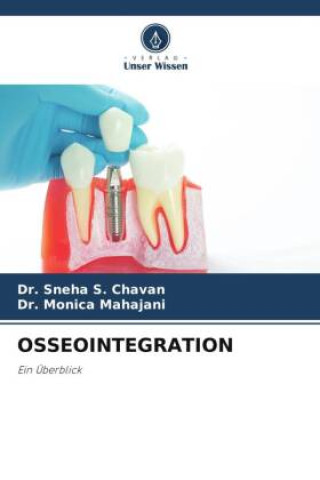 Knjiga OSSEOINTEGRATION Monica Mahajani