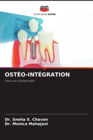 Knjiga OSTÉO-INTÉGRATION Monica Mahajani