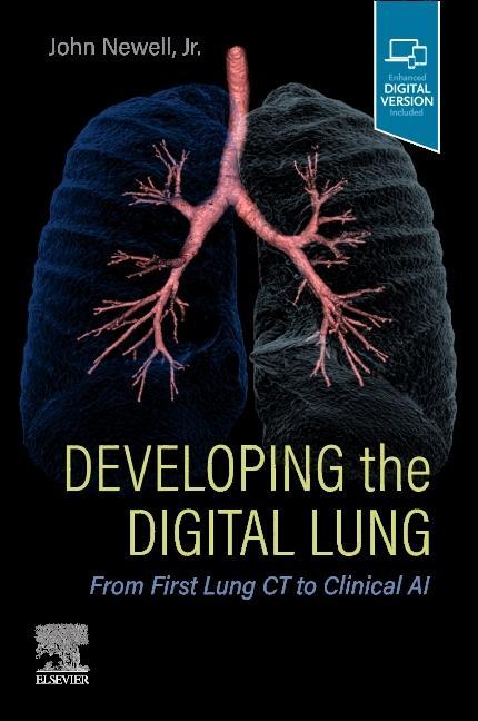 Knjiga Developing the Digital Lung John D. Newell