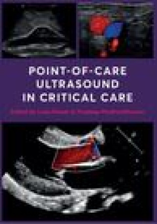 Könyv Point-of-Care Ultrasound in Critical Care 
