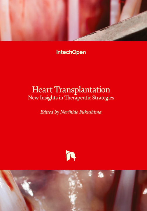 Kniha Heart Transplantation 