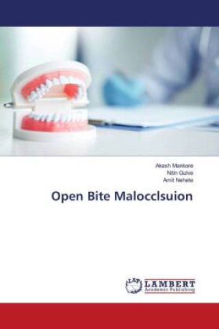 Knjiga Open Bite Malocclsuion Nitin Gulve