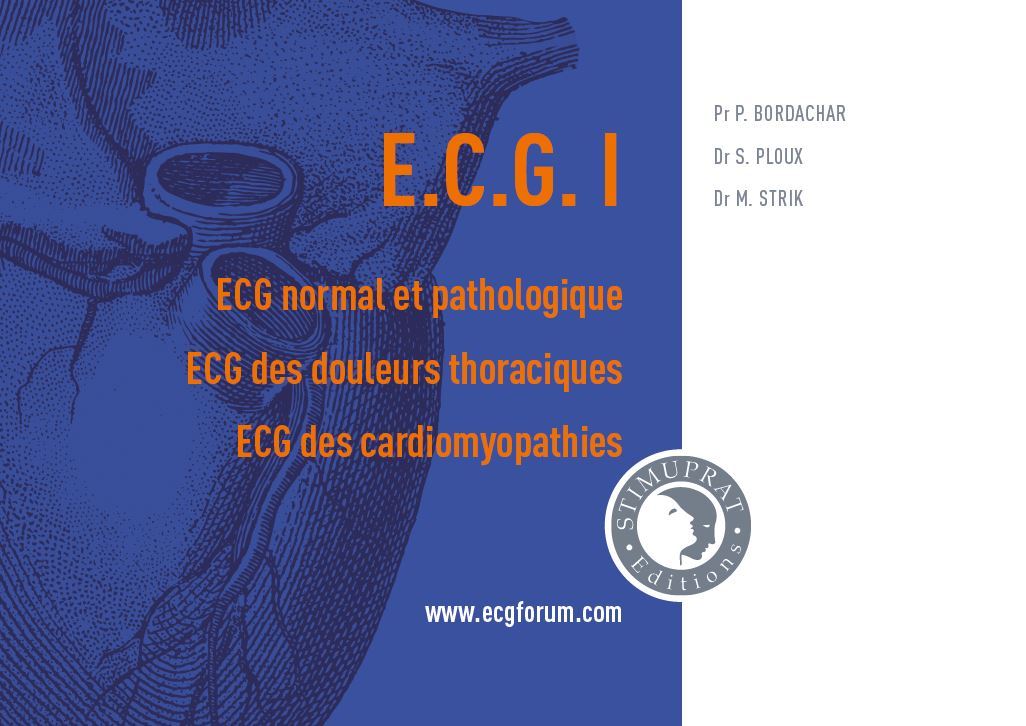 Könyv ECG I : ECG normal et pathologique, ECG des douleurs thoraciques, ECG des cardiomyopathies Pr