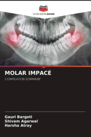 Book MOLAR IMPACÉ Shivam Agarwal