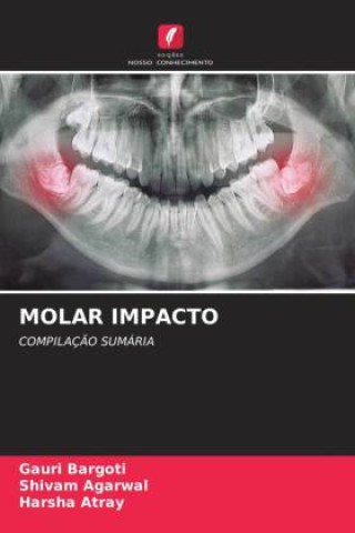 Buch MOLAR IMPACTO Shivam Agarwal