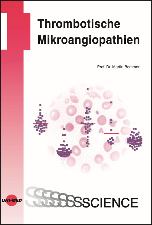 Könyv Thrombotische Mikroangiopathien 