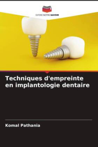 Knjiga Techniques d'empreinte en implantologie dentaire Komal Pathania
