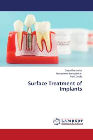 Kniha Surface Treatment of Implants Banashree Sankeshwari