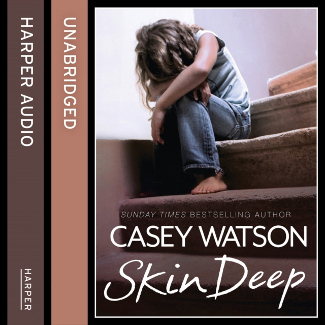 Audiokniha Skin Deep: All she wanted was a mummy, but was she too ugly to be loved? Casey Watson