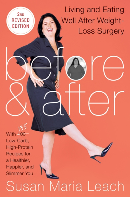 E-knjiga Before & After, Second Revised Edition Susan Maria Leach