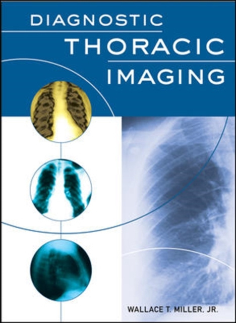E-book Diagnostic Thoracic Imaging Wallace T. Miller