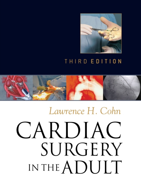 E-book Cardiac Surgery in the Adult, Third Edition Lawrence Cohn