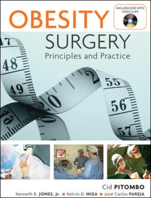 E-kniha Obesity Surgery: Principles and Practice Cid Pitombo