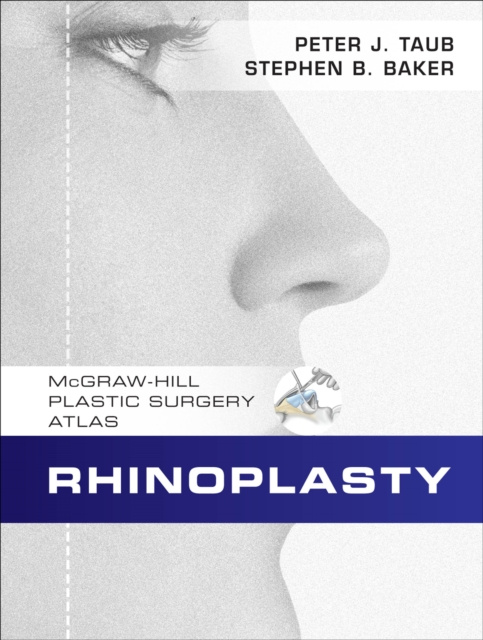 E-knjiga Rhinoplasty Peter J. Taub
