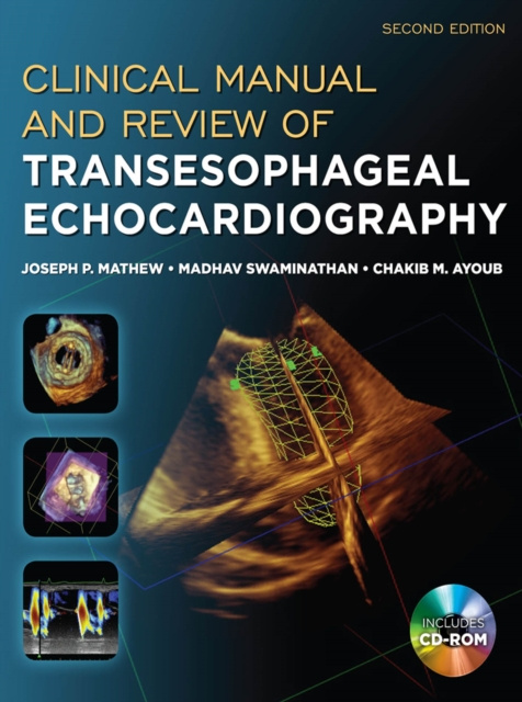 E-kniha Clinical Manual and Review of Transesophageal Echocardiography, Second Edition Joseph Mathew