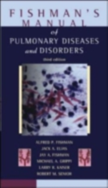 E-kniha Fishman's Pulmonary Diseases and Disorders, Fourth Edition Alfred P. Fishman