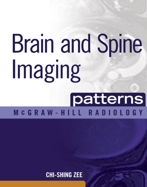 E-kniha Brain and Spine Imaging Patterns Chi-Shing Zee