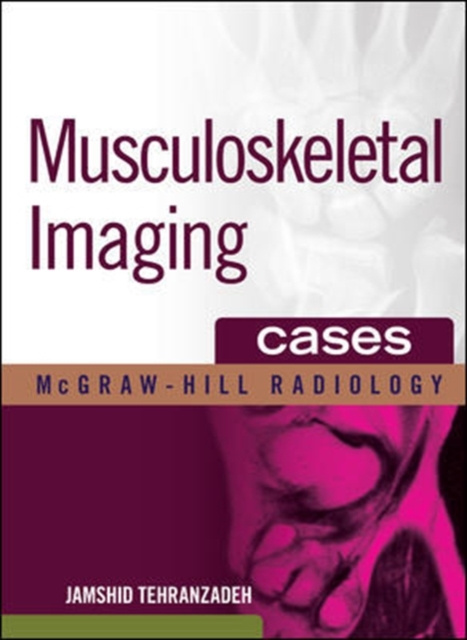 E-knjiga Musculoskeletal Imaging Cases Jamshid Tehranzadeh