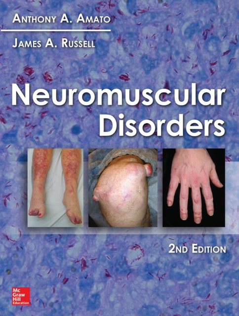 E-book Neuromuscular Disorders, 2nd Edition Anthony A. Amato