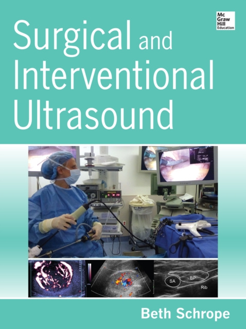 E-kniha Surgical and Interventional Ultrasound Beth Schrope