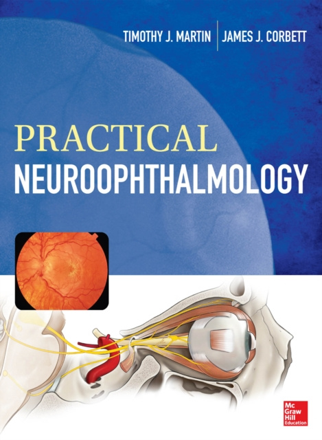 E-book Practical Neuroophthalmology Timothy J. Martin