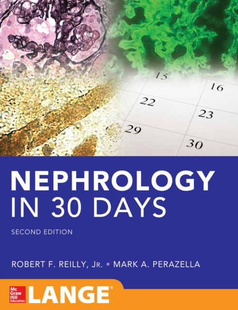 E-book Nephrology in 30 Days Robert Reilly