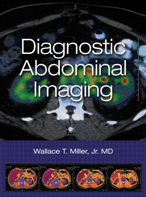 E-knjiga Diagnostic Abdominal Imaging Wallace T. Miller