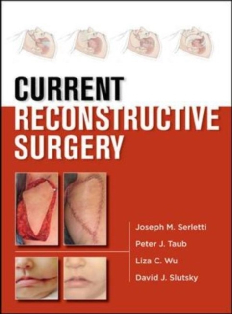 E-knjiga Current Reconstructive Surgery Joseph M. Serletti