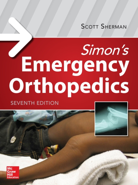 E-Book Simon's Emergency Orthopedics Scott C. Sherman