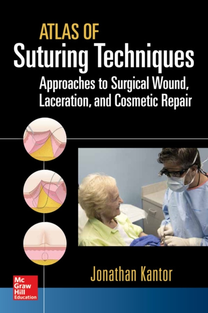 E-kniha Atlas of Suturing Techniques: Approaches to Surgical Wound, Laceration, and Cosmetic Repair Jonathan Kantor