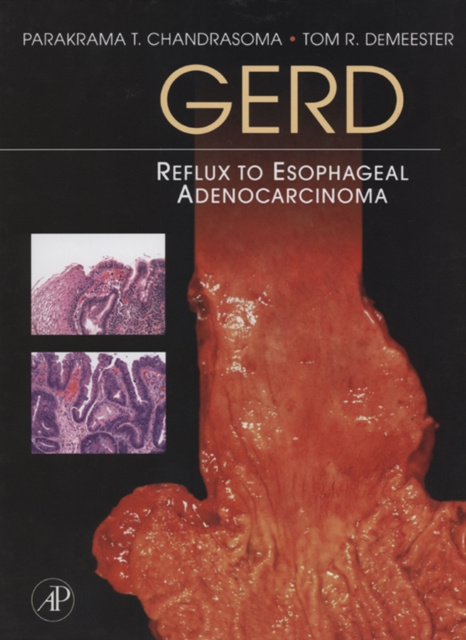 E-book GERD Parakrama T. Chandrasoma