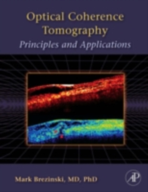E-knjiga Optical Coherence Tomography Mark E. Brezinski