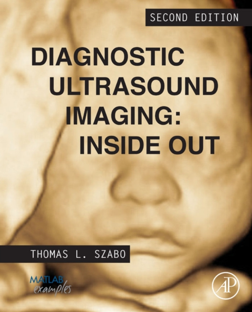 E-Book Diagnostic Ultrasound Imaging: Inside Out Thomas L. Szabo