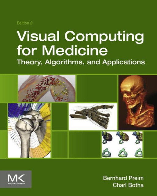 E-book Visual Computing for Medicine Bernhard Preim