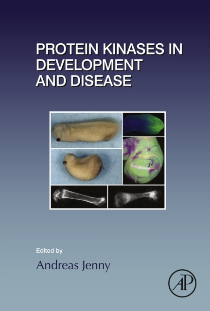 E-book Protein Kinases in Development and Disease Andreas Jenny