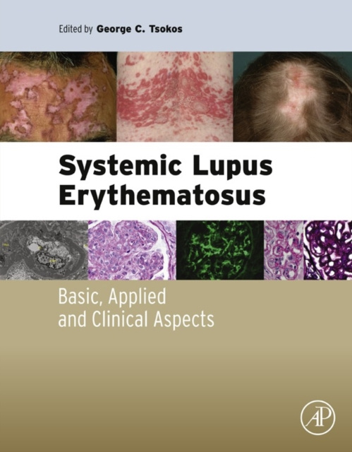 E-book Systemic Lupus Erythematosus George Tsokos