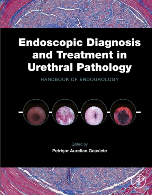 E-kniha Endoscopic Diagnosis and Treatment in Urethral Pathology Petrisor Aurelian Geavlete