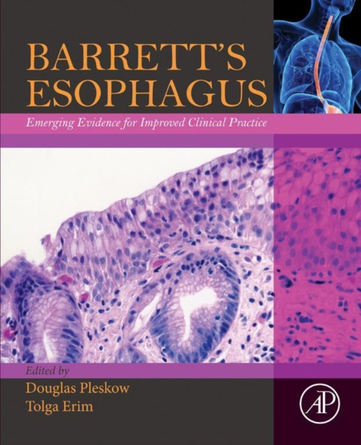 E-kniha Barrett's Esophagus Douglas Pleskow