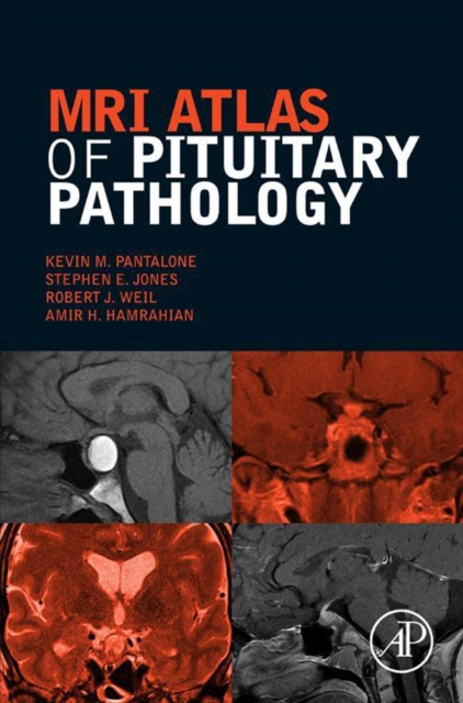E-kniha MRI Atlas of Pituitary Pathology Kevin M. Pantalone