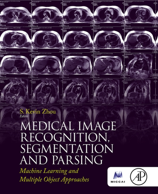 E-kniha Medical Image Recognition, Segmentation and Parsing Kevin Zhou