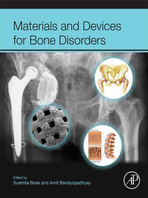 E-book Materials and Devices for Bone Disorders Susmita Bose